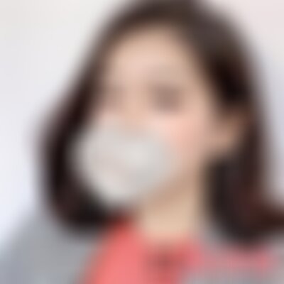 广州曙光医院去凹疤效果好吗