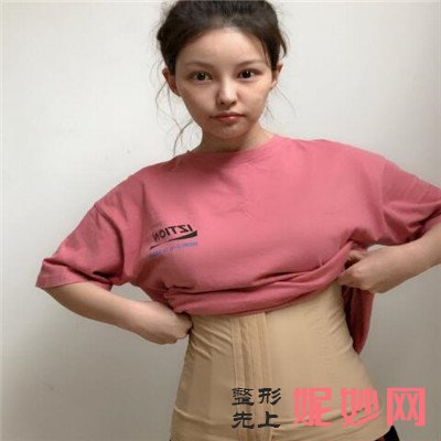 北京润美玉之光吸脂好吗