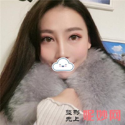 成都艾米丽的全脸填充怎么样