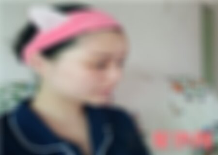 北医三院整形科谁重睑提肌做得好