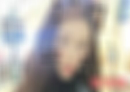 北医三院整形科谁重睑提肌做得好