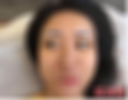 沈阳杏林整形医院切眉多少钱