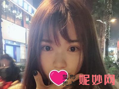 常州美莱做眼睛好吗