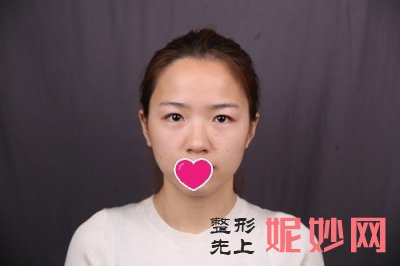 常州美莱做眼睛好吗