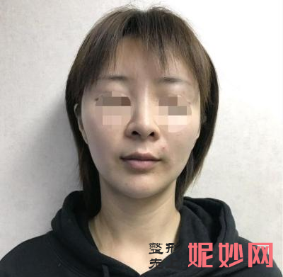 北京润美玉之光能植眉吗？多少钱？