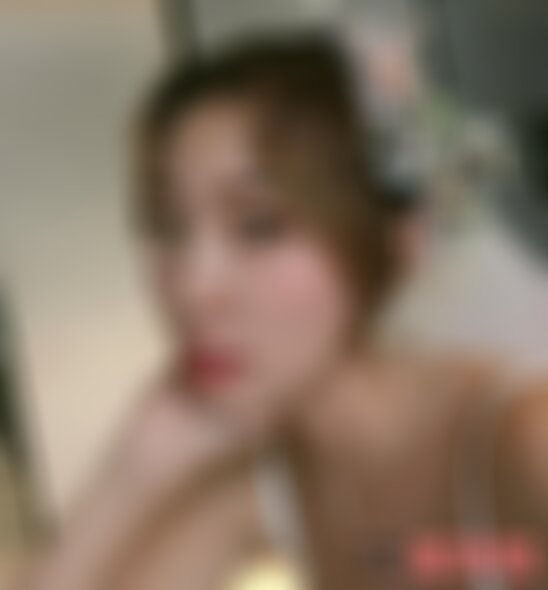 北医三院鼻整形案例怎么样