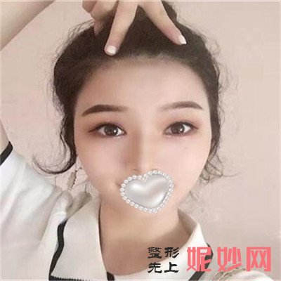 广州曙光美容去脸上疤痕多少钱