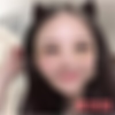 北京黄寺整容医院于波开眼角案例