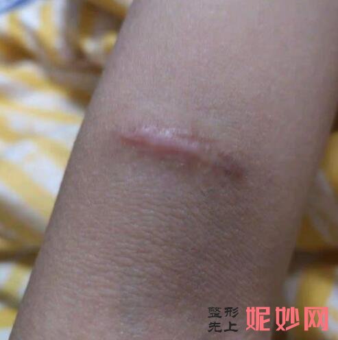 西京整形医院哪个医生疤痕做的好