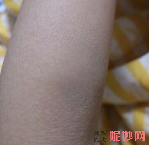 西京整形医院哪个医生疤痕做的好