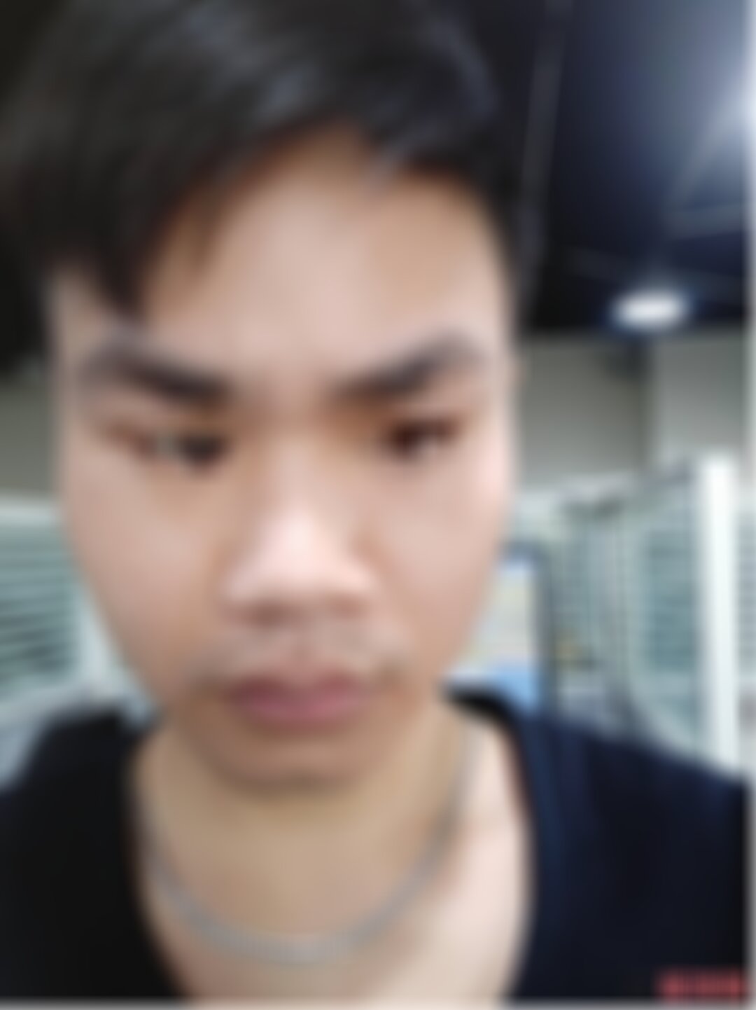 北医三院整形凹陷疤痕吗