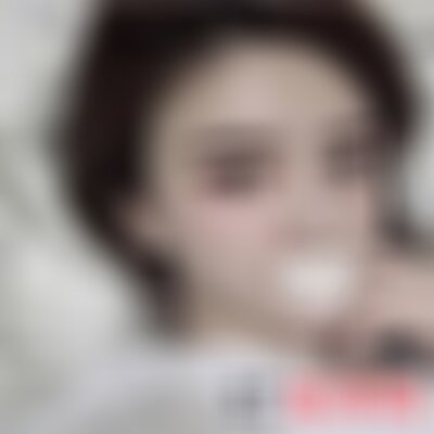 沈阳杏林整形医院极线音波拉皮怎么样