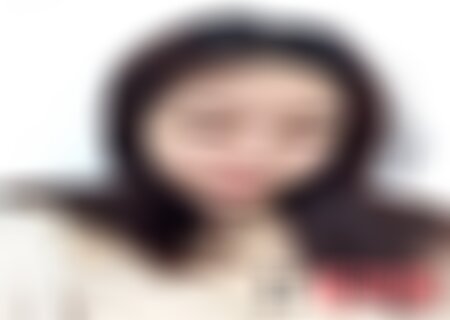 重庆西南整形医院双眼皮案例