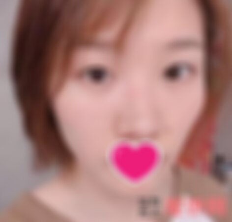 西京整形医院修复眼袋怎么样