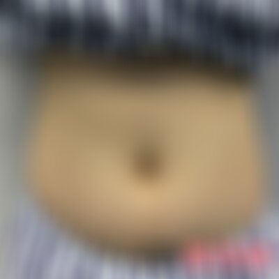 北京黄寺美容整形医院吸脂怎么样