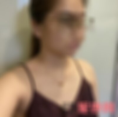 沈阳杏林整形医院丰胸好不好