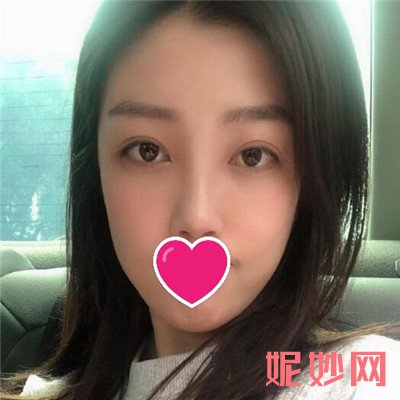 成美整形做眼袋怎么样