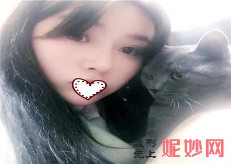 重庆西南整形医院隆鼻案例