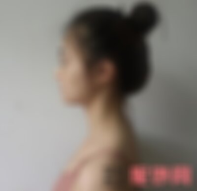 北京韩啸隆鼻怎么样