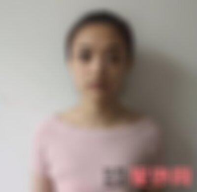 北京韩啸隆鼻怎么样