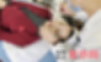 成都晶肤光子嫩肤怎么样