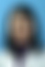 上海华山医院眼部整形怎么样