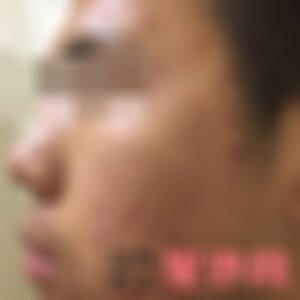 武汉美基元医疗美容医院口碑好吗？