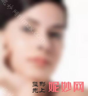 硅胶歪鼻修复可靠吗