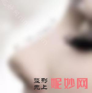 硅胶歪鼻修复可靠吗