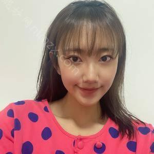 广州拉皮手术好吗?在广州军美医疗美容医院做了拉皮整形恢复之后效果是这样的