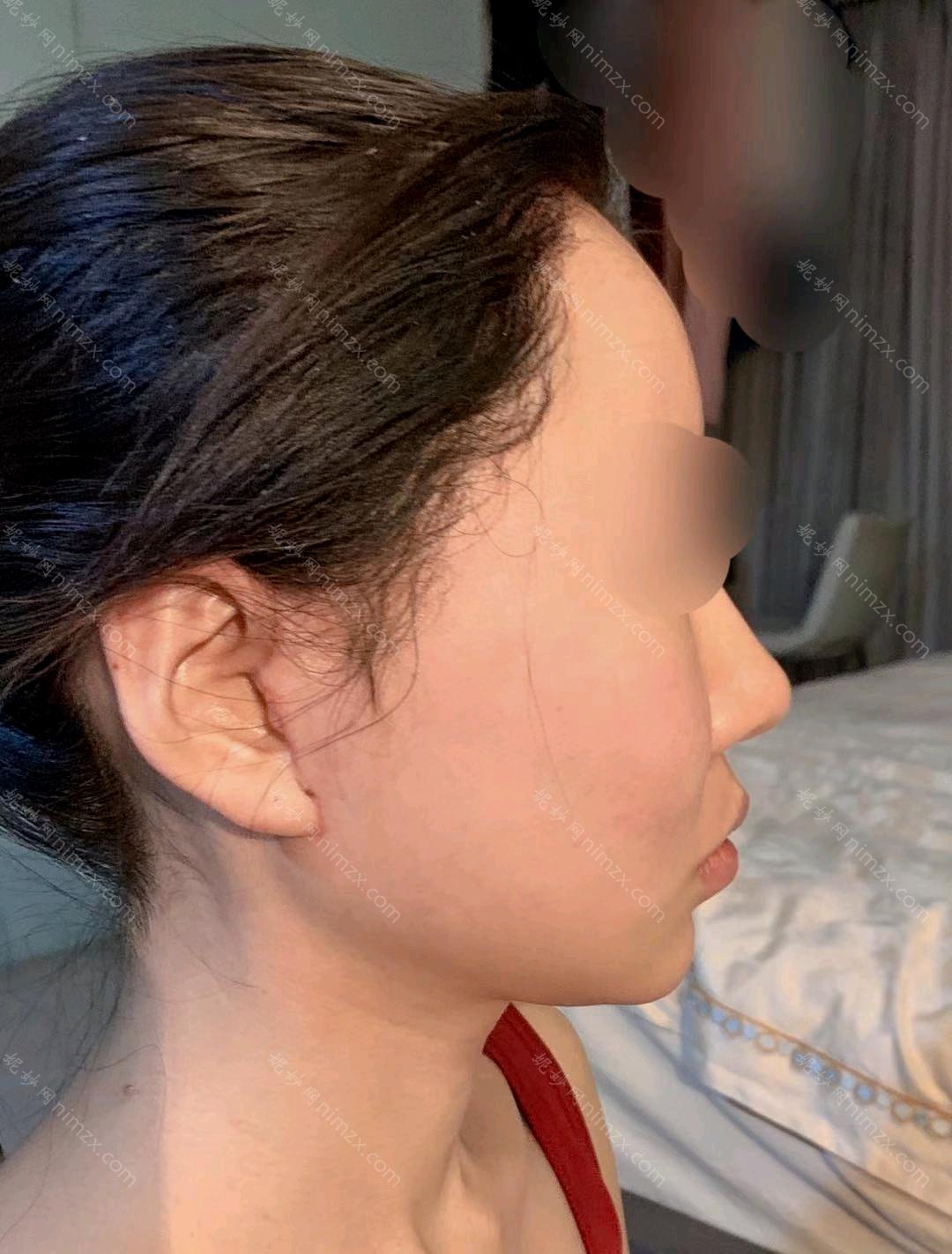 郑州熙禾整形医院怎么样?有做过的人说他的整形靠谱吗?