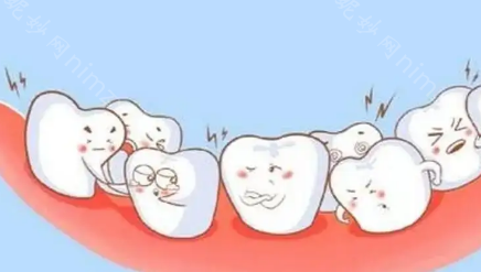 科普|牙齿矫正有没有年龄限制？什么时候做牙齿矫正更合适