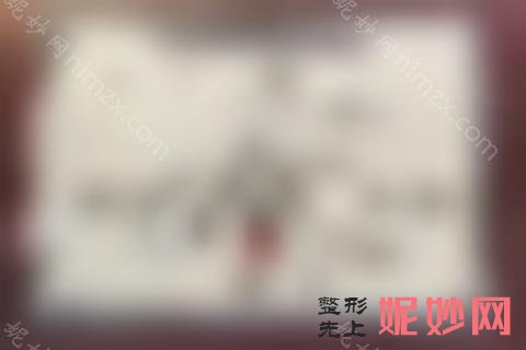 郑州牙齿矫正医院排名前十,详解郑州牙齿矫正医院哪家好!