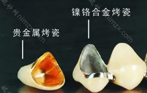 年纪轻轻做了10颗烤瓷牙，结果牙齿全发炎了我不想活了