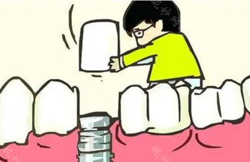 全瓷牙和烤瓷牙有哪些区别?全瓷牙图片和价格分享