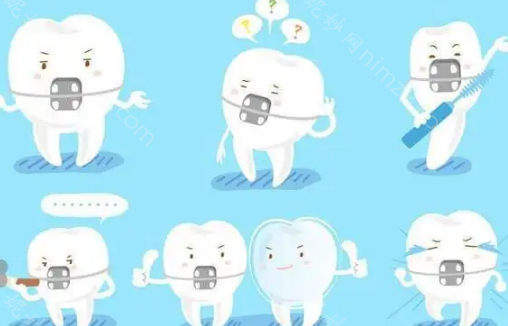 牙齿矫正带给人的变化有多大?牙套矫正前后图片分享