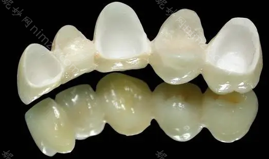 烤瓷牙300的和500有什么区别?烤瓷牙材料有哪些?