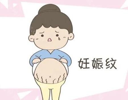 微针妊娠纹做了5次之后有用吗?附相关科普分享