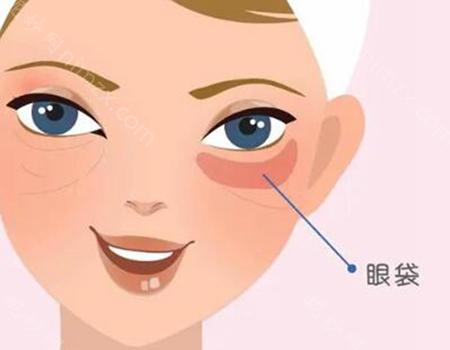眼袋手术1--10天图片怎么样?推荐实力医院,分析医院技术