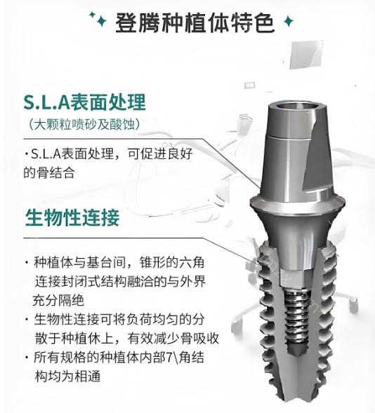 登腾种植牙真相解析：性价比之选的优缺点及使用寿命全揭秘