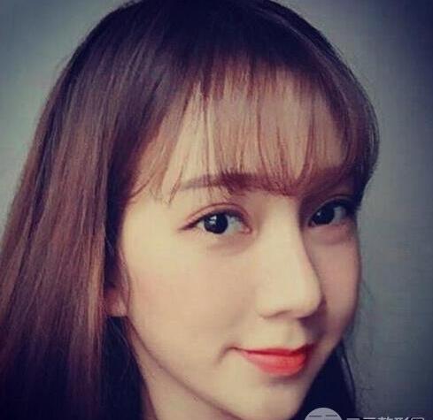 成都铜雀台徐敦双眼皮怎么样?徐敦个人简介_案例效果图照片