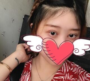 上海九院王涛专家眼部整形怎么样?王涛简历_门诊时间_开眼角案例效果图价格