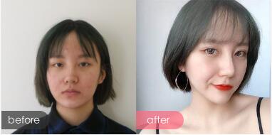 广州广美整形医院口碑好不好?手术效果怎么样?会导致医疗事故发生吗?