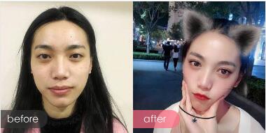 广州广美整形医院口碑好不好?手术效果怎么样?会导致医疗事故发生吗?