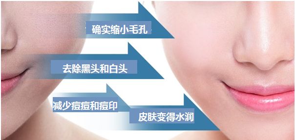 25岁可以做黑脸娃娃吗