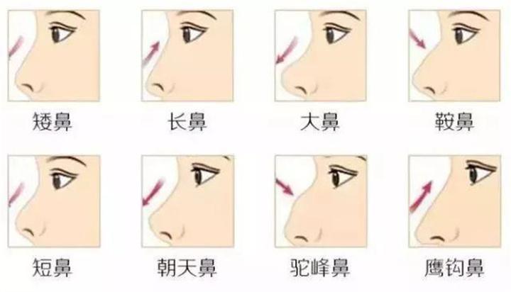 乌鲁木齐划痕治疗酒渣鼻手术的费用有哪些影响因素