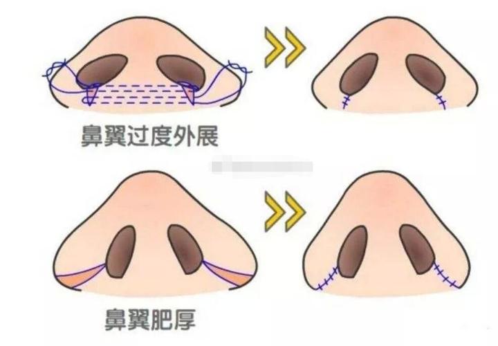 2025年武警黑龙江总队医院整形美容科费用全解析
