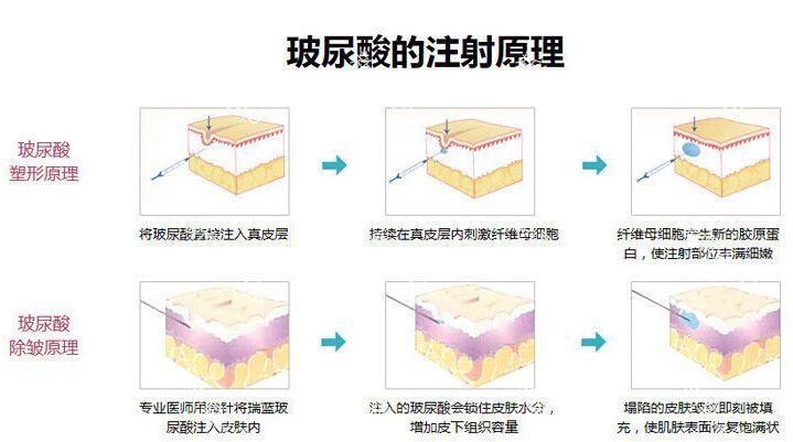 中山爱思特整形价格费用多少？详细项目费用一览