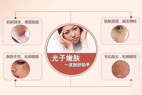 沧州中心医院激光美容科价格及效果分析