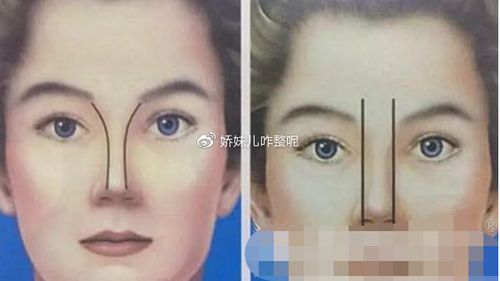 哈尔滨欧华整形医院整形项目价格费用多少？详细清单大曝光！